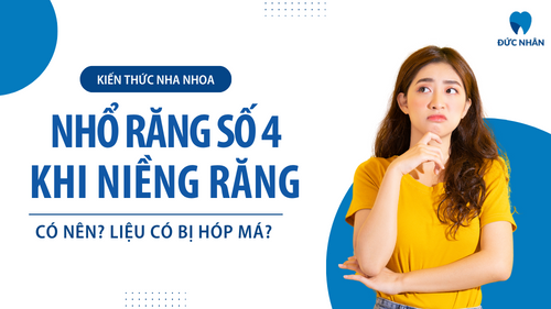 Nhổ răng số 4 khi niềng răng? Có nên không và liệu có bị hóp má?